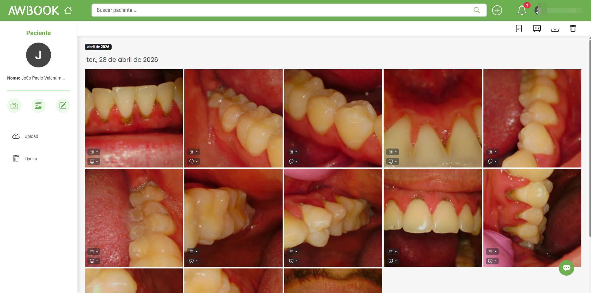 Galeria visual do paciente no AWBOOK Net